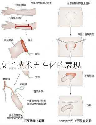 女子技术男性化的表现